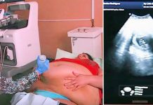 Trudna žena ima 226 kilograma i došla je na ultrazvuk, a onda je medicinska sestra podigla njen stomak i pogledala bolje… (VIDEO) Trudna žena ima 226 kilograma i došla je na ultrazvuk, a onda je medicinska sestra podigla njen stomak i pogledala bolje… (VIDEO) - featured image