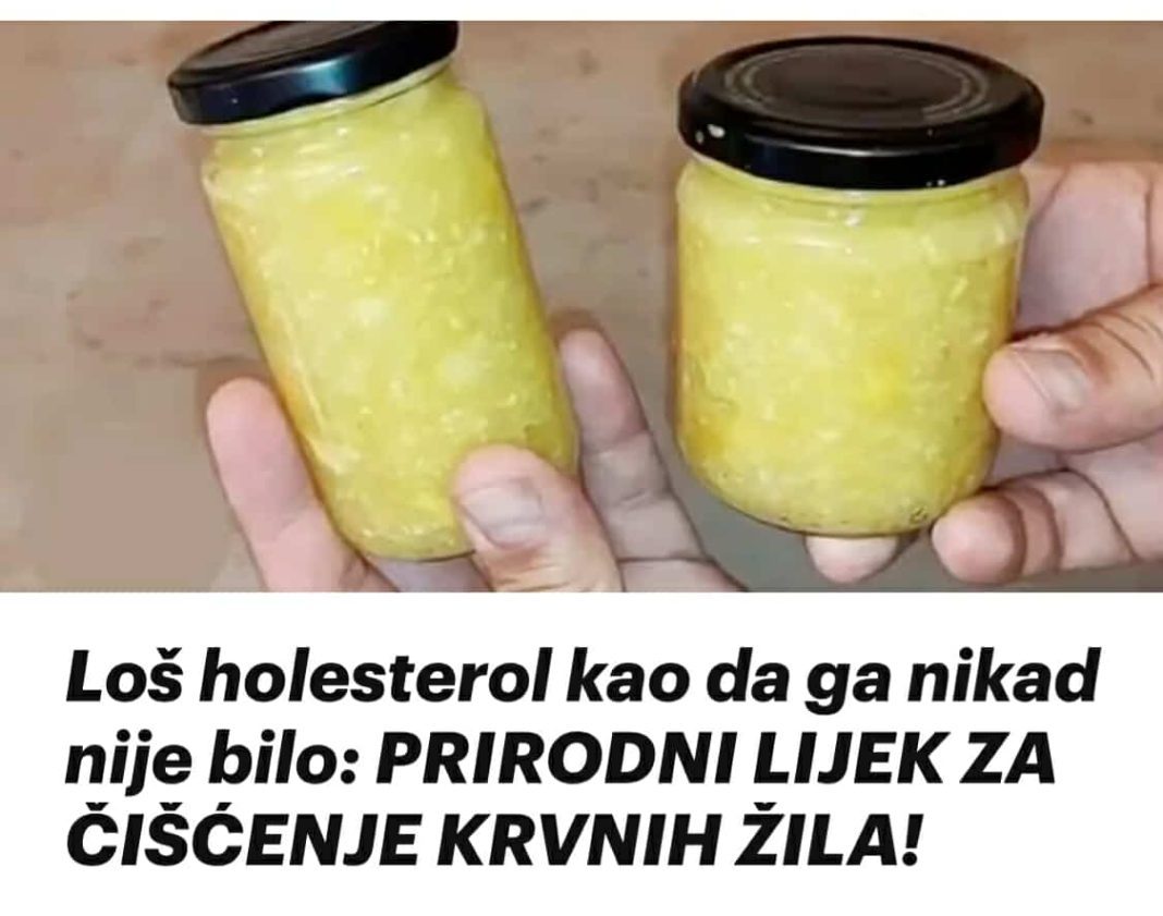 Loš holesterol kao da ga nikad nije bilo: PRIRODNI LIJEK ZA ČIŠĆENJE KRVNIH ŽILA! - featured image