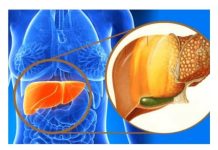 SVE VEĆI BROJ LJUDI IMA MASNU JETRU: Uzrok nije ALKOHOL, već jedan sastojak za koji SVI MISLE DA JE ZDRAV