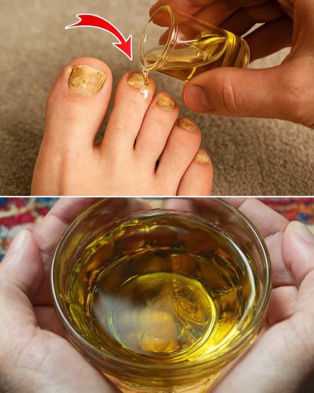 Ovo prirodno ulje mi je spasilo nokte! đ Zdravi nokti nakon samo par tretmana…SAMA SE UVJERILA DA FUNKCIONIĆ E… - featured image Ovo prirodno ulje mi je spasilo nokte! đ Zdravi nokti nakon samo par tretmana…SAMA SE UVJERILA DA FUNKCIONIĆ E… - featured image