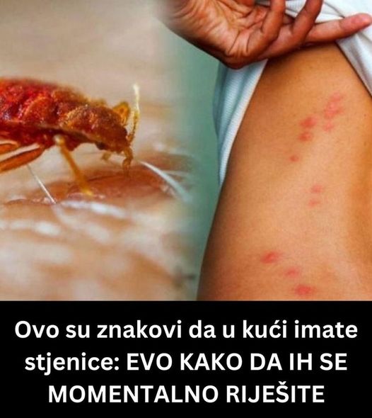 STJENICE U DOMU: PREPOZNAJTE IH NA VRIJEME I RIJEŠITE SE NAJBRŽE MOGUĆE - featured image STJENICE U DOMU: PREPOZNAJTE IH NA VRIJEME I RIJEŠITE SE NAJBRŽE MOGUĆE - featured image