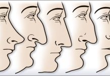 ZVUČI ČUDNO, ALI JE ISTINITO: Evo šta OBLIK NOSA govori O VAMA! Svima je pogodilo ZVUČI ČUDNO, ALI JE ISTINITO: Evo šta OBLIK NOSA govori O VAMA! Svima je pogodilo - featured image