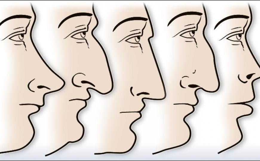 ZVUČI ČUDNO, ALI JE ISTINITO: Evo šta OBLIK NOSA govori O VAMA! Svima je pogodilo - featured image