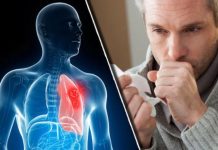 Nikad više nećete dobiti bronhitis i kašalj: Prirodni lek za decu i odrasle Nikad više nećete dobiti bronhitis i kašalj: Prirodni lek za decu i odrasle - featured image