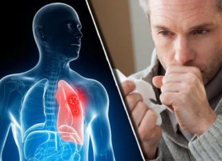 Nikad više nećete dobiti bronhitis i kašalj: Prirodni lek za decu i odrasle Nikad više nećete dobiti bronhitis i kašalj: Prirodni lek za decu i odrasle - featured image