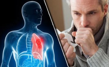 Nikad više nećete dobiti bronhitis i kašalj: Prirodni lek za decu i odrasle Nikad više nećete dobiti bronhitis i kašalj: Prirodni lek za decu i odrasle - featured image