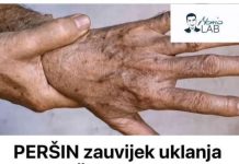 PERŠIN Zauvijek Uklanja STARAČKE MRLJE! Ovo Morate Napraviti… PERŠIN Zauvijek Uklanja STARAČKE MRLJE! Ovo Morate Napraviti… - featured image