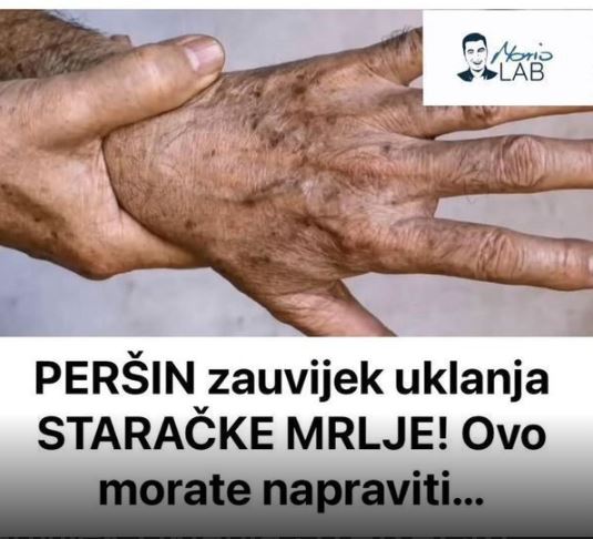 PERŠIN Zauvijek Uklanja STARAČKE MRLJE! Ovo Morate Napraviti… - featured image
