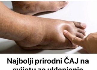 Recept za Najbolji Prirodni ČAJ Na Svijetu Za Uklanjanje 0TEKLINA! Recept za Najbolji Prirodni ČAJ Na Svijetu Za Uklanjanje 0TEKLINA! - featured image