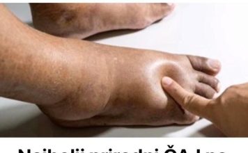 Recept za Najbolji Prirodni ČAJ Na Svijetu Za Uklanjanje 0TEKLINA! Recept za Najbolji Prirodni ČAJ Na Svijetu Za Uklanjanje 0TEKLINA! - featured image