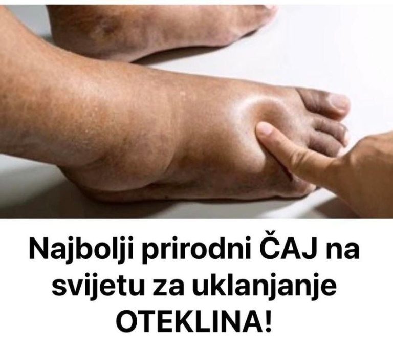 Recept za Najbolji Prirodni ČAJ Na Svijetu Za Uklanjanje 0TEKLINA! - featured image