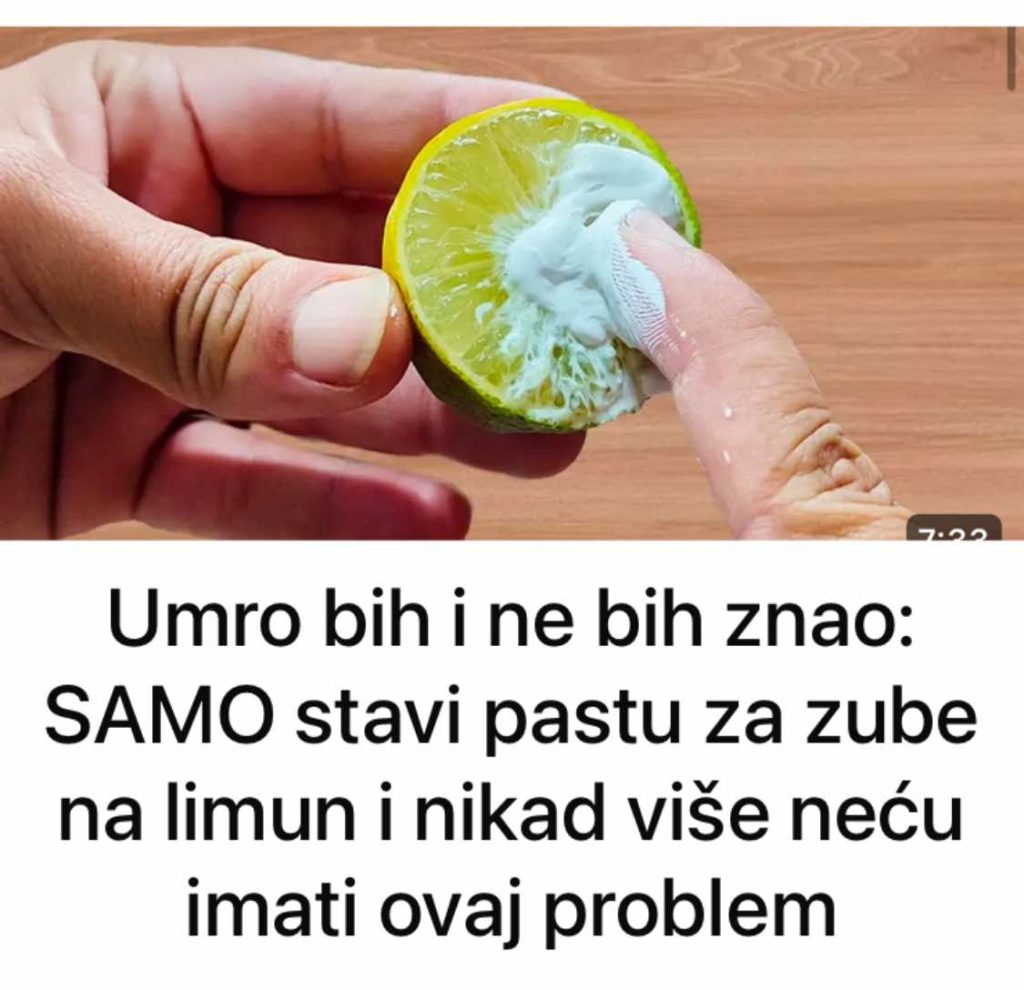 Umro bih i ne bih znao: SAMO stavi pastu za zube na limun i nikad više neću imati ovaj problem - featured image
