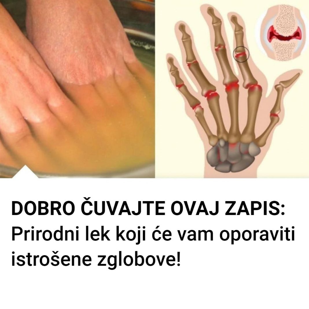 Bolovi u zglobovima ruku i nogu simptomi i lečenje - featured image
