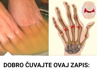 Bolovi u zglobovima ruku i nogu simptomi i lečenje Bolovi u zglobovima ruku i nogu simptomi i lečenje - featured image