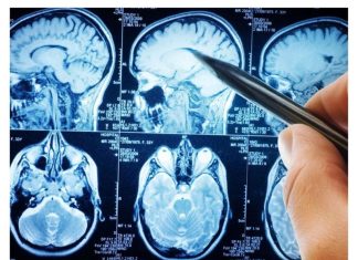 POVRĆE JE TOLIKO ZDRAVO DA O NJEMU PIŠE NJUJORK TAJMS: Amerikanci daju po 30 dolara za jedan list, a ono raste kod nas POVRĆE JE TOLIKO ZDRAVO DA O NJEMU PIŠE NJUJORK TAJMS: Amerikanci daju po 30 dolara za jedan list, a ono raste kod nas - featured image