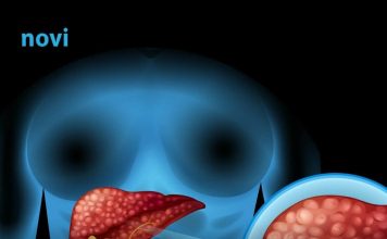 Ovo su 3 simptoma koja ukazuju na moguće probleme s jetrom Ovo su 3 simptoma koja ukazuju na moguće probleme s jetrom - featured image