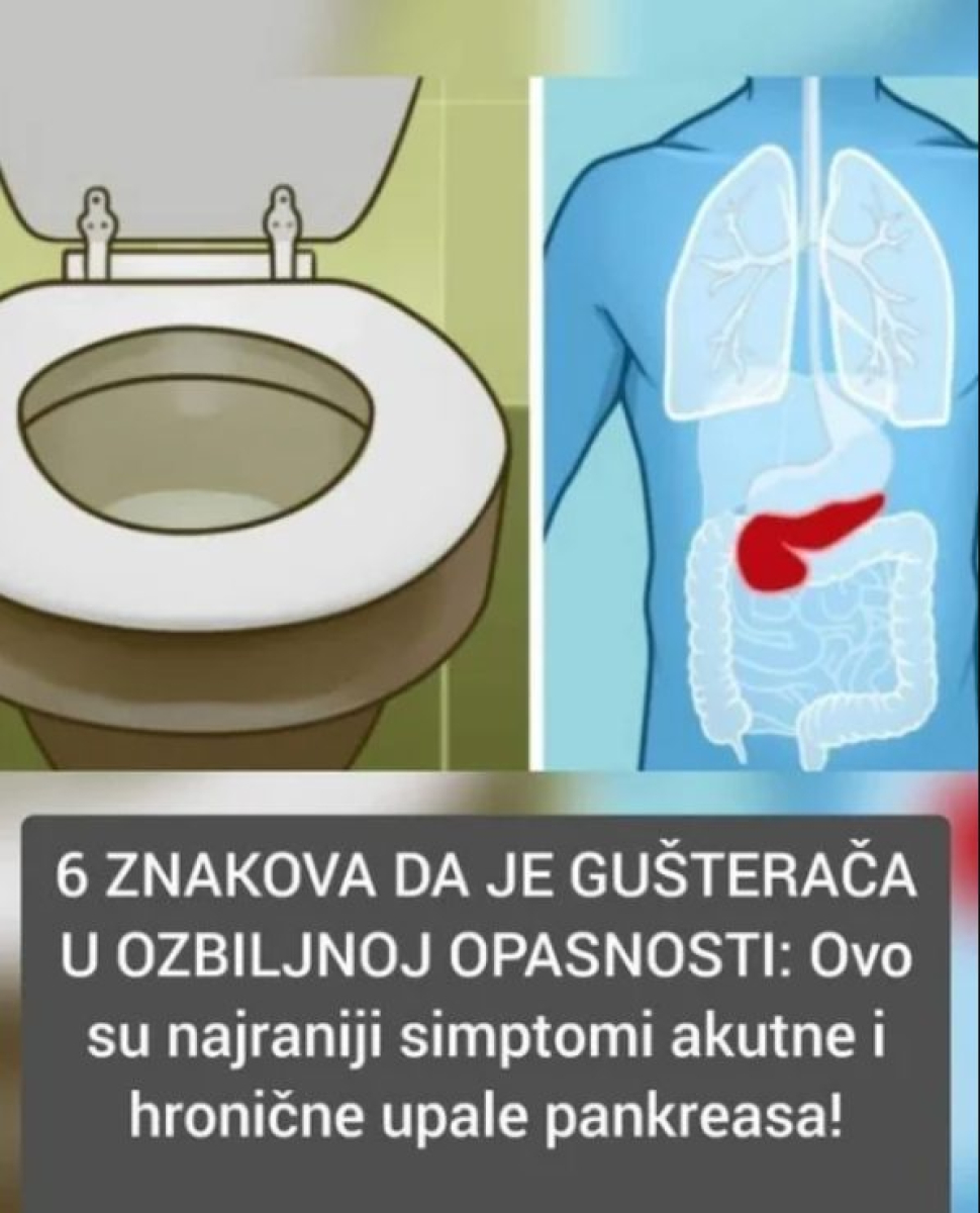 6 ZNAK0VA DA JE GUŠTERAČA U VELlK0J 0PASN0STI - featured image 6 ZNAK0VA DA JE GUŠTERAČA U VELlK0J 0PASN0STI - featured image