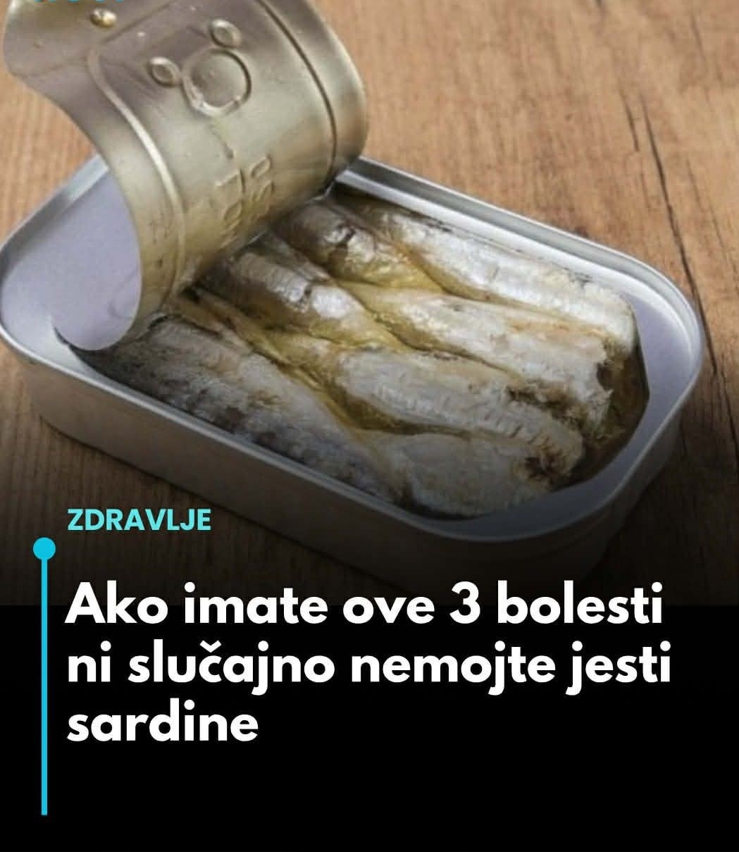 Ako imate ove 3 bolesti ni slučajno nemojte jesti sardine… - featured image Ako imate ove 3 bolesti ni slučajno nemojte jesti sardine… - featured image