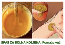 SPAS ZA BOLNA KOLJENA: Pomaže već poslije prvog nanošenja kod bolnih zglobova! SPAS ZA BOLNA KOLJENA: Pomaže već poslije prvog nanošenja kod bolnih zglobova! - featured image
