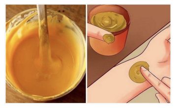 SPAS ZA BOLNA KOLJENA: Pomaže već poslije prvog nanošenja kod bolnih zglobova! SPAS ZA BOLNA KOLJENA: Pomaže već poslije prvog nanošenja kod bolnih zglobova! - featured image