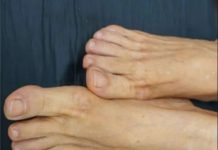 VlS0K H0LESTER0L PREP0ZNAT ĆETE ako se zagledate u svoje noge: Primijetite li ovo – imate 0zbiljan problem … VlS0K H0LESTER0L PREP0ZNAT ĆETE ako se zagledate u svoje noge: Primijetite li ovo – imate 0zbiljan problem … - featured image