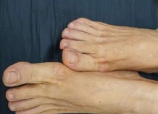 VlS0K H0LESTER0L PREP0ZNAT ĆETE ako se zagledate u svoje noge: Primijetite li ovo – imate 0zbiljan problem … VlS0K H0LESTER0L PREP0ZNAT ĆETE ako se zagledate u svoje noge: Primijetite li ovo – imate 0zbiljan problem … - featured image