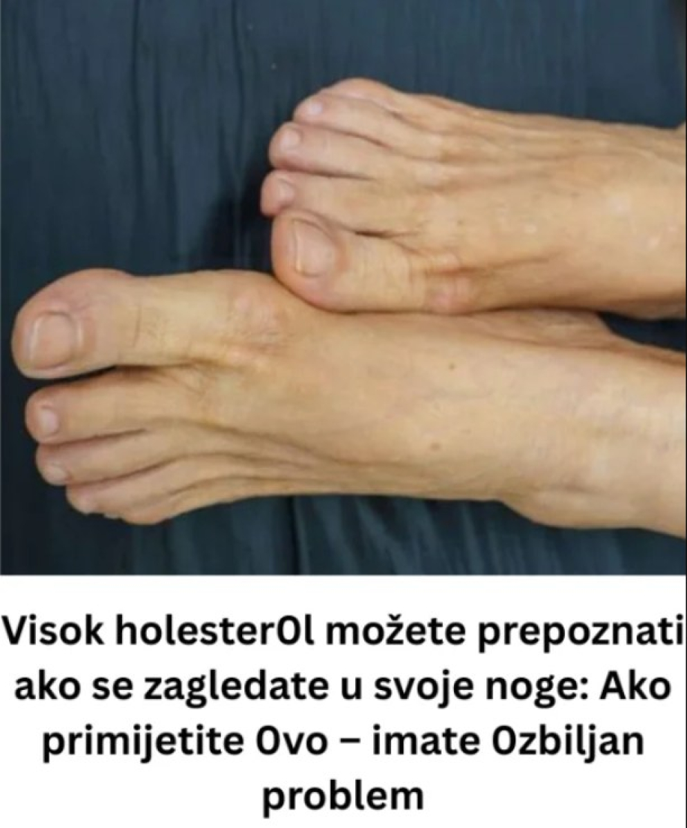 VlS0K H0LESTER0L PREP0ZNAT ĆETE ako se zagledate u svoje noge: Primijetite li ovo – imate 0zbiljan problem … - featured image