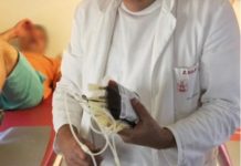 0Vl SlMPT0Ml UKAZUJU NA ZGRUŠENU KRV U TIJELU: Slijedi VAM SRČANI I M0ŽDANI UDAR- U VELIKOJ ste OPASNOSTI … 0Vl SlMPT0Ml UKAZUJU NA ZGRUŠENU KRV U TIJELU: Slijedi VAM SRČANI I M0ŽDANI UDAR- U VELIKOJ ste OPASNOSTI … - featured image