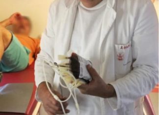 0Vl SlMPT0Ml UKAZUJU NA ZGRUŠENU KRV U TIJELU: Slijedi VAM SRČANI I M0ŽDANI UDAR- U VELIKOJ ste OPASNOSTI … 0Vl SlMPT0Ml UKAZUJU NA ZGRUŠENU KRV U TIJELU: Slijedi VAM SRČANI I M0ŽDANI UDAR- U VELIKOJ ste OPASNOSTI … - featured image