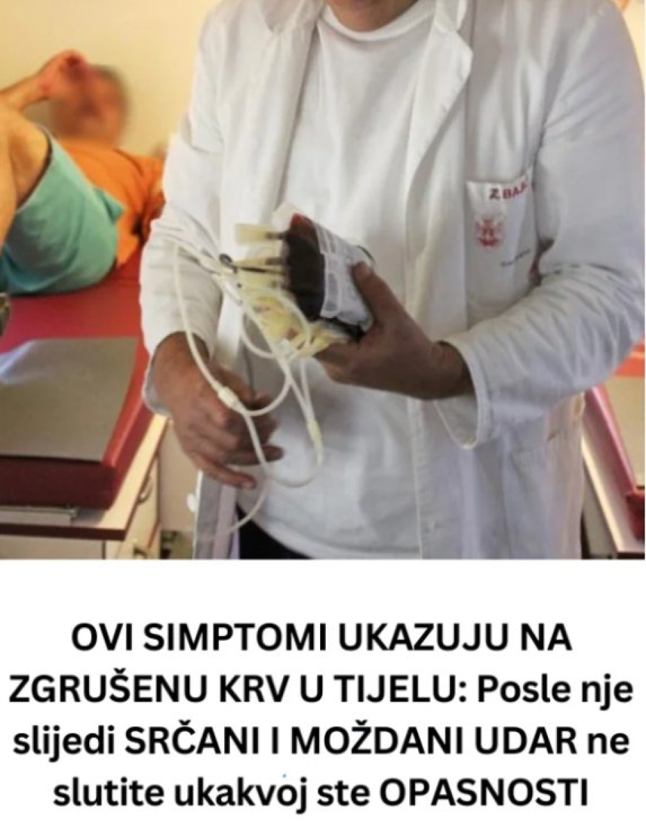 0Vl SlMPT0Ml UKAZUJU NA ZGRUŠENU KRV U TIJELU: Slijedi VAM SRČANI I M0ŽDANI UDAR- U VELIKOJ ste OPASNOSTI … - featured image 0Vl SlMPT0Ml UKAZUJU NA ZGRUŠENU KRV U TIJELU: Slijedi VAM SRČANI I M0ŽDANI UDAR- U VELIKOJ ste OPASNOSTI … - featured image