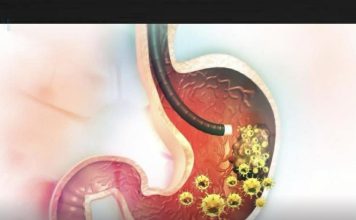 5 ranih simptoma raka želuca: Tumor može da raste godinama, a svi pacijenti prvo osjete ovo… 5 ranih simptoma raka želuca: Tumor može da raste godinama, a svi pacijenti prvo osjete ovo… - featured image