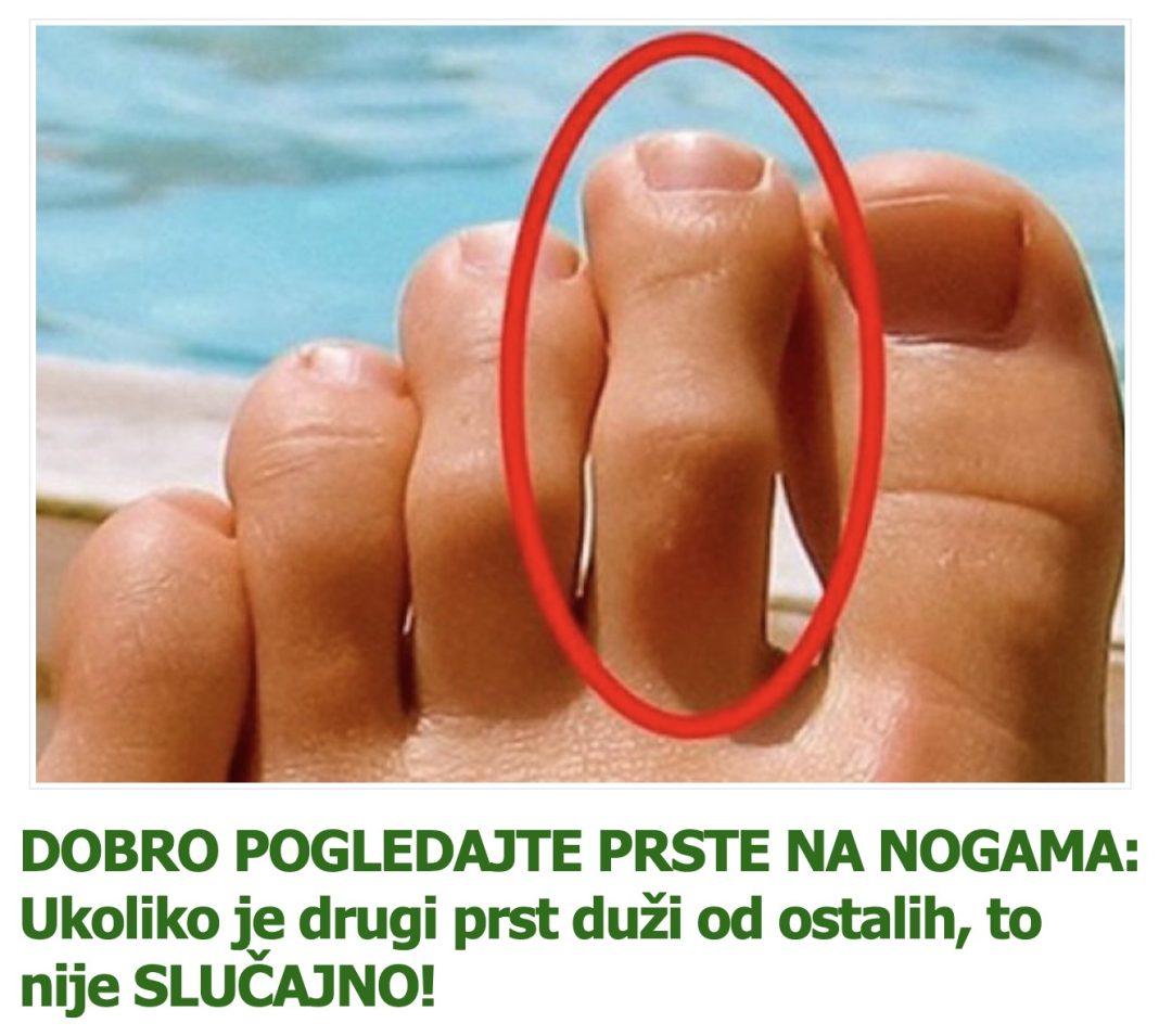 DOBRO POGLEDAJTE PRSTE NA NOGAMA: Ukoliko je drugi prst duži od ostalih, to nije SLUČAJNO! - featured image
