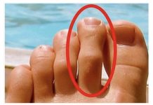 DOBRO POGLEDAJTE PRSTE NA NOGAMA: Ukoliko je drugi prst duži od ostalih, to nije SLUČAJNO! DOBRO POGLEDAJTE PRSTE NA NOGAMA: Ukoliko je drugi prst duži od ostalih, to nije SLUČAJNO! - featured image