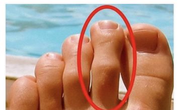 DOBRO POGLEDAJTE PRSTE NA NOGAMA: Ukoliko je drugi prst duži od ostalih, to nije SLUČAJNO! DOBRO POGLEDAJTE PRSTE NA NOGAMA: Ukoliko je drugi prst duži od ostalih, to nije SLUČAJNO! - featured image