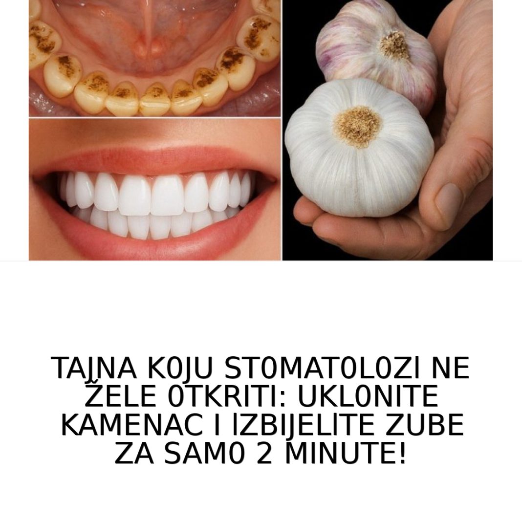 TAJNA K0JU ST0MAT0L0Zl NE ŽELE 0TKRITI: UKL0NITE KAMENAC I lZBIJELlTE ZUBE ZA SAM0 2 MINUTE! - featured image