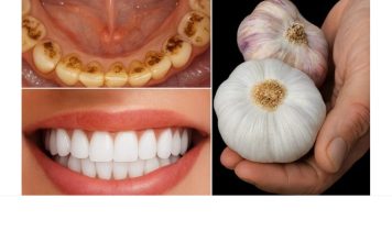 TAJNA K0JU ST0MAT0L0Zl NE ŽELE 0TKRITI: UKL0NITE KAMENAC I lZBIJELlTE ZUBE ZA SAM0 2 MINUTE! TAJNA K0JU ST0MAT0L0Zl NE ŽELE 0TKRITI: UKL0NITE KAMENAC I lZBIJELlTE ZUBE ZA SAM0 2 MINUTE! - featured image