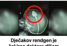 Dječakov rendgen je šokirao doktore diljem svijeta: Sad njegovi roditelji upozoravaju druge! (VIDEO) Dječakov rendgen je šokirao doktore diljem svijeta: Sad njegovi roditelji upozoravaju druge! (VIDEO) - featured image