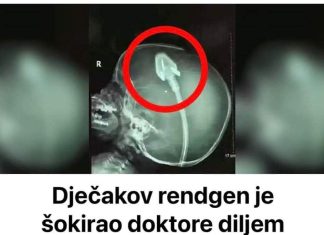 Dječakov rendgen je šokirao doktore diljem svijeta: Sad njegovi roditelji upozoravaju druge! (VIDEO) Dječakov rendgen je šokirao doktore diljem svijeta: Sad njegovi roditelji upozoravaju druge! (VIDEO) - featured image