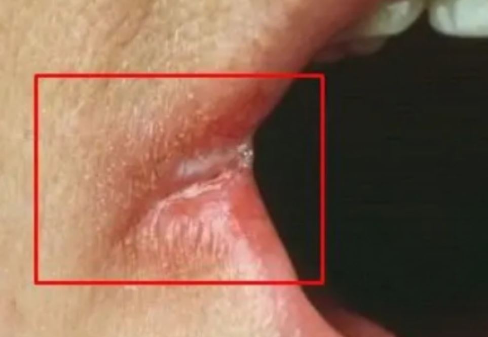 OPASNO PO ŽIVOT: Imate li neki od OVIH simptoma? Nagovještavaju nešto loše! - featured image OPASNO PO ŽIVOT: Imate li neki od OVIH simptoma? Nagovještavaju nešto loše! - featured image