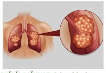 PUŠAČI, PAŽNJA! Za 3 dana izbacite sve otrove iz tijela: Ova metoda skida OTROV SA ZIDOVA PLUĆA, sprečava rak, izbacuje masnoće i višak vode! PUŠAČI, PAŽNJA! Za 3 dana izbacite sve otrove iz tijela: Ova metoda skida OTROV SA ZIDOVA PLUĆA, sprečava rak, izbacuje masnoće i višak vode! - featured image