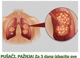 PUŠAČI, PAŽNJA! Za 3 dana izbacite sve otrove iz tijela: Ova metoda skida OTROV SA ZIDOVA PLUĆA, sprečava rak, izbacuje masnoće i višak vode! PUŠAČI, PAŽNJA! Za 3 dana izbacite sve otrove iz tijela: Ova metoda skida OTROV SA ZIDOVA PLUĆA, sprečava rak, izbacuje masnoće i višak vode! - featured image