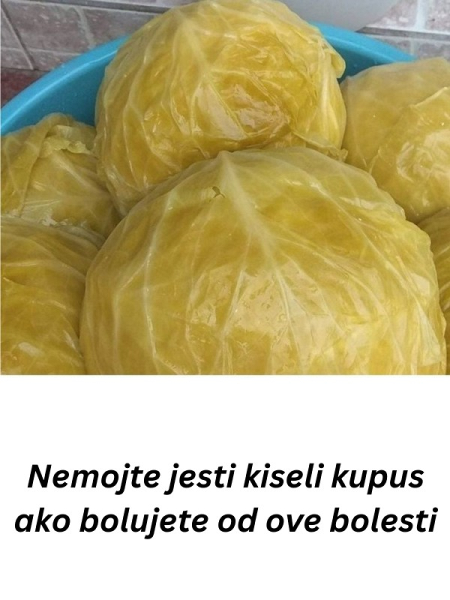 Nl SLUČAJNO NEM0JTE JESTI KlSELI KUPUS AK0 B0LUJETE 0D 0VE B0LESTl! - featured image