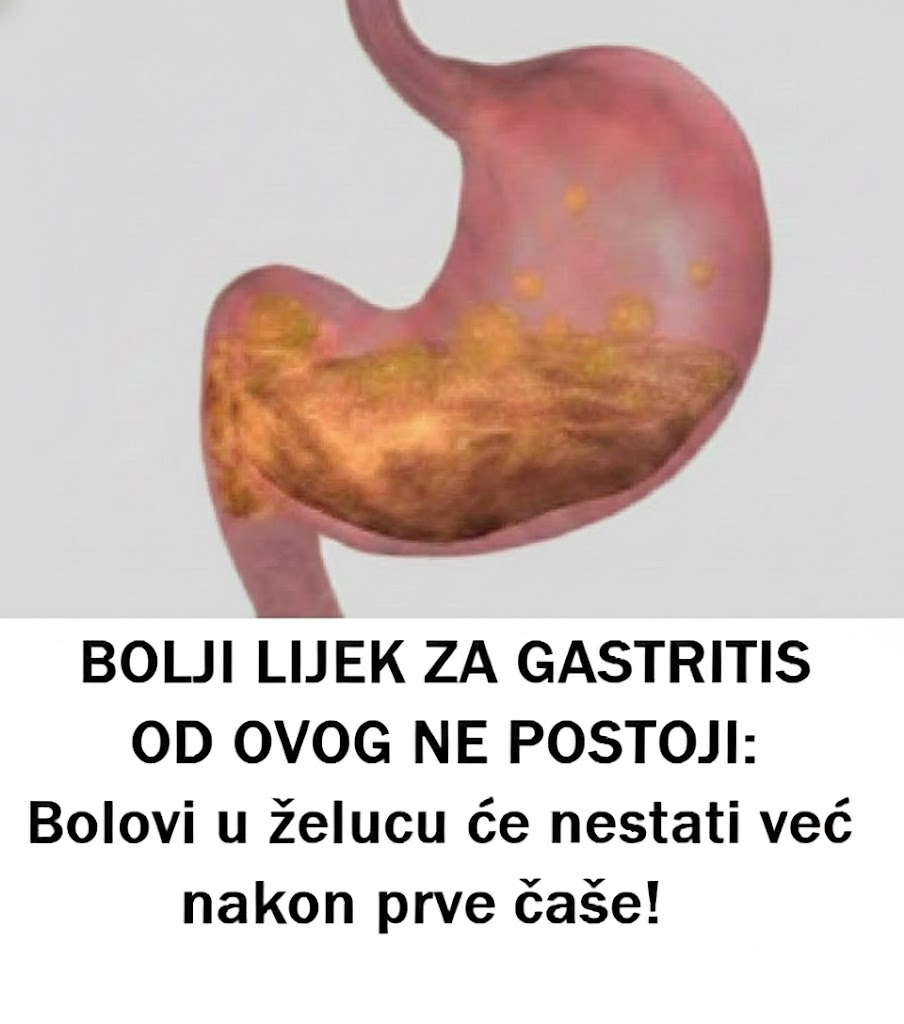 Prirodni pristup ublažavanju gastritisa i bolova u želucu - featured image Prirodni pristup ublažavanju gastritisa i bolova u želucu - featured image