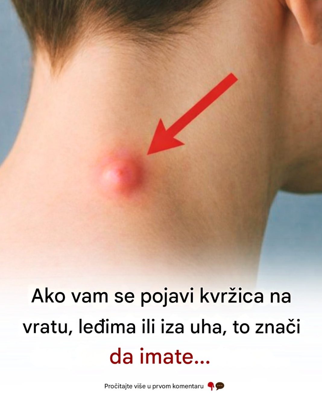 Ako vam se pojavi kvržica na vratu, leđima ili iza uha, to znači da… pogledajte više 👀👇 - featured image
