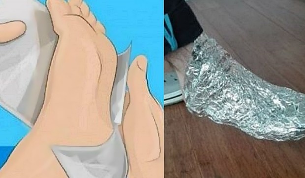 ZAMOTALA SAM NOGE U ALU FOLIJU I DRŽALA SAT VREMENA: REZULTAT JE FENOMENALAN- Evo šta se desilo! - featured image ZAMOTALA SAM NOGE U ALU FOLIJU I DRŽALA SAT VREMENA: REZULTAT JE FENOMENALAN- Evo šta se desilo! - featured image