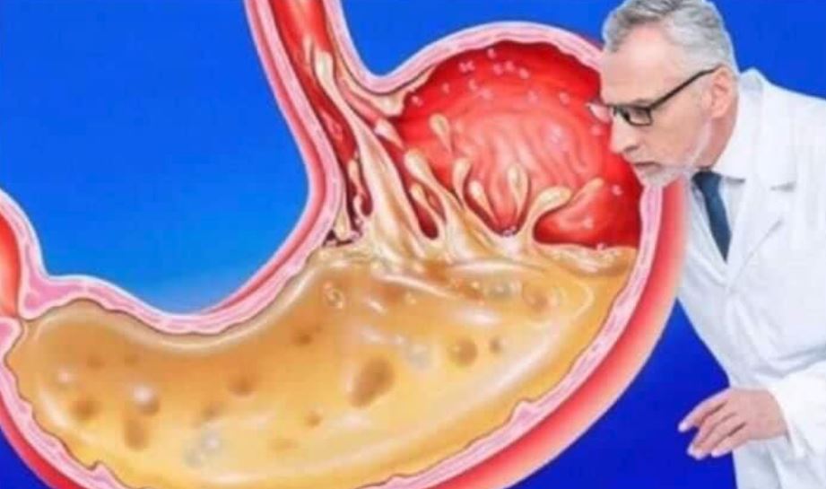 OVO JEDITE ZA VEČERU 3 DANA ZAREDOM: Nećete vjerovati šta će izaći iz vašeg stomaka - featured image