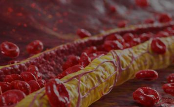 Ovi znaci na nogama pokazuju da imate izuzetno visok holesterol: Ne smijete ih ignorisati, posljedice su fatalne po tijelo Ovi znaci na nogama pokazuju da imate izuzetno visok holesterol: Ne smijete ih ignorisati, posljedice su fatalne po tijelo - featured image