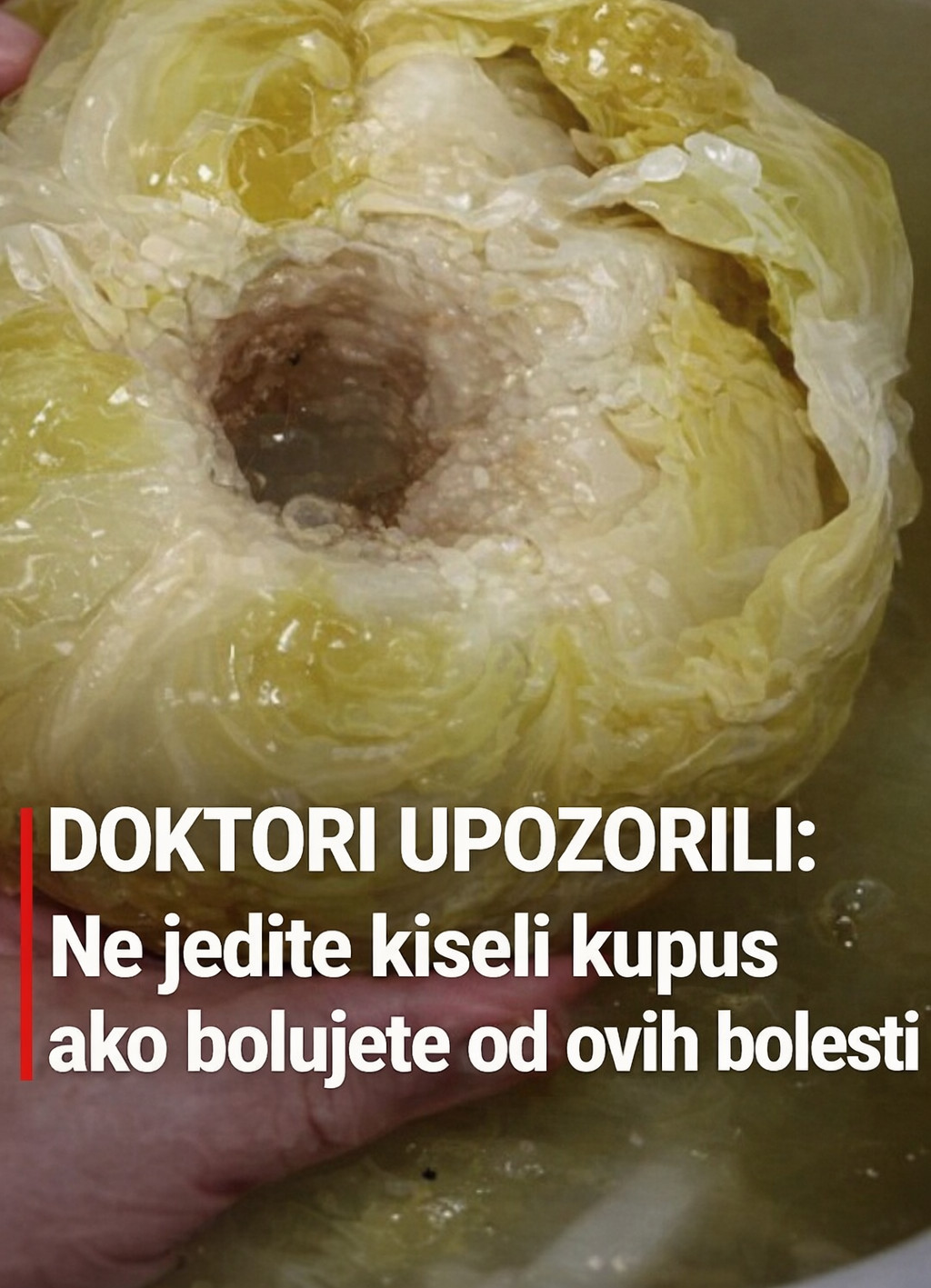 DOKTORI UPOZORILI: Ne jedite kiseli kupus ako bolujete od ovih bolesti - featured image