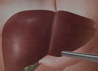 Jetra pod pritiskom: namirnice koje je opterećuju gotovo kao alkohol Jetra pod pritiskom: namirnice koje je opterećuju gotovo kao alkohol - featured image