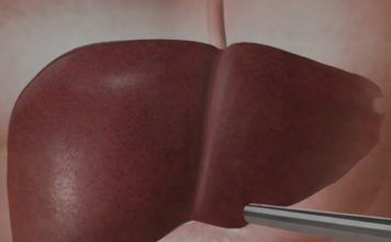 Jetra pod pritiskom: namirnice koje je opterećuju gotovo kao alkohol Jetra pod pritiskom: namirnice koje je opterećuju gotovo kao alkohol - featured image